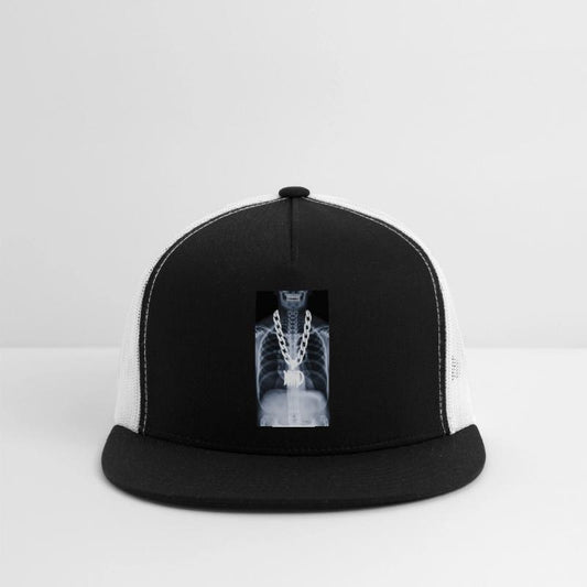 Xray of a hip-hopper